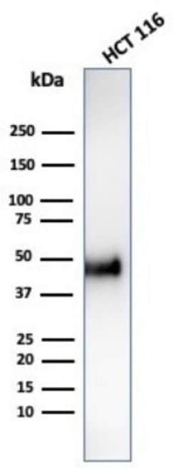 Cyclin E1 Antibody (CCNE1/4935R) - Azide and BSA Free, Novus Biologicals 100 &mu;g | Buy Online | Novus Biologicals | Fisher Scientific